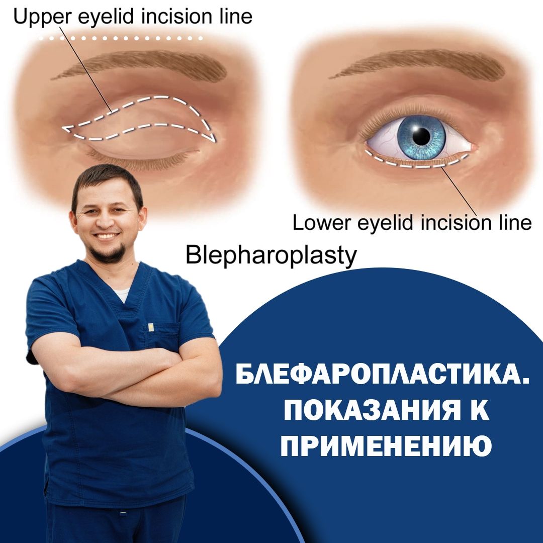 5244776743913501244_121 https://lor-rinoplastika.com/wp-content/uploads/2020/01/5244776743913501244_121.jpg