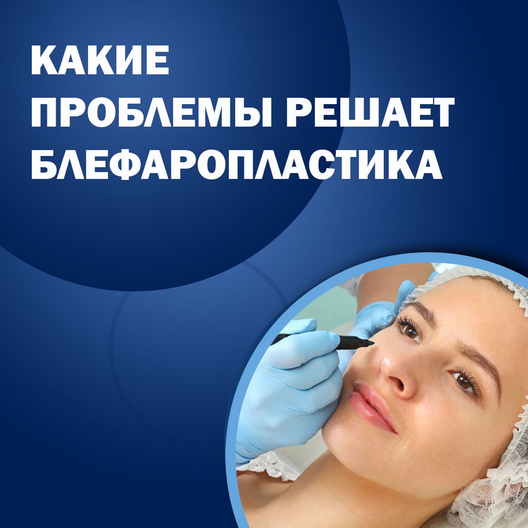 5341764402606617807_121 https://lor-rinoplastika.com/wp-content/uploads/2020/01/5341764402606617807_121.jpg