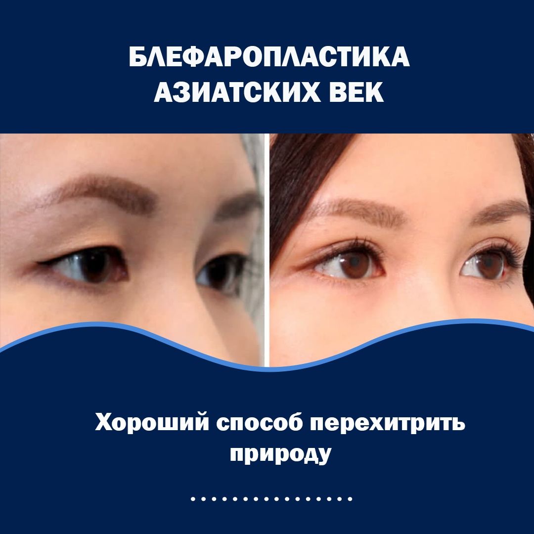 5204158812993467790_121 https://lor-rinoplastika.com/wp-content/uploads/2021/08/5204158812993467790_121.jpg